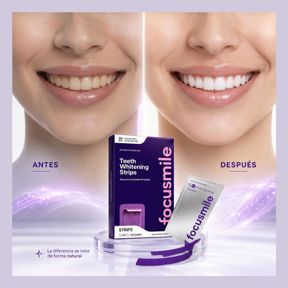 SMILEKIT CINTAS BLANQUEADORAS
