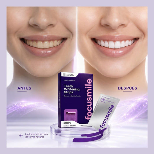 SMILEKIT CINTAS BLANQUEADORAS
