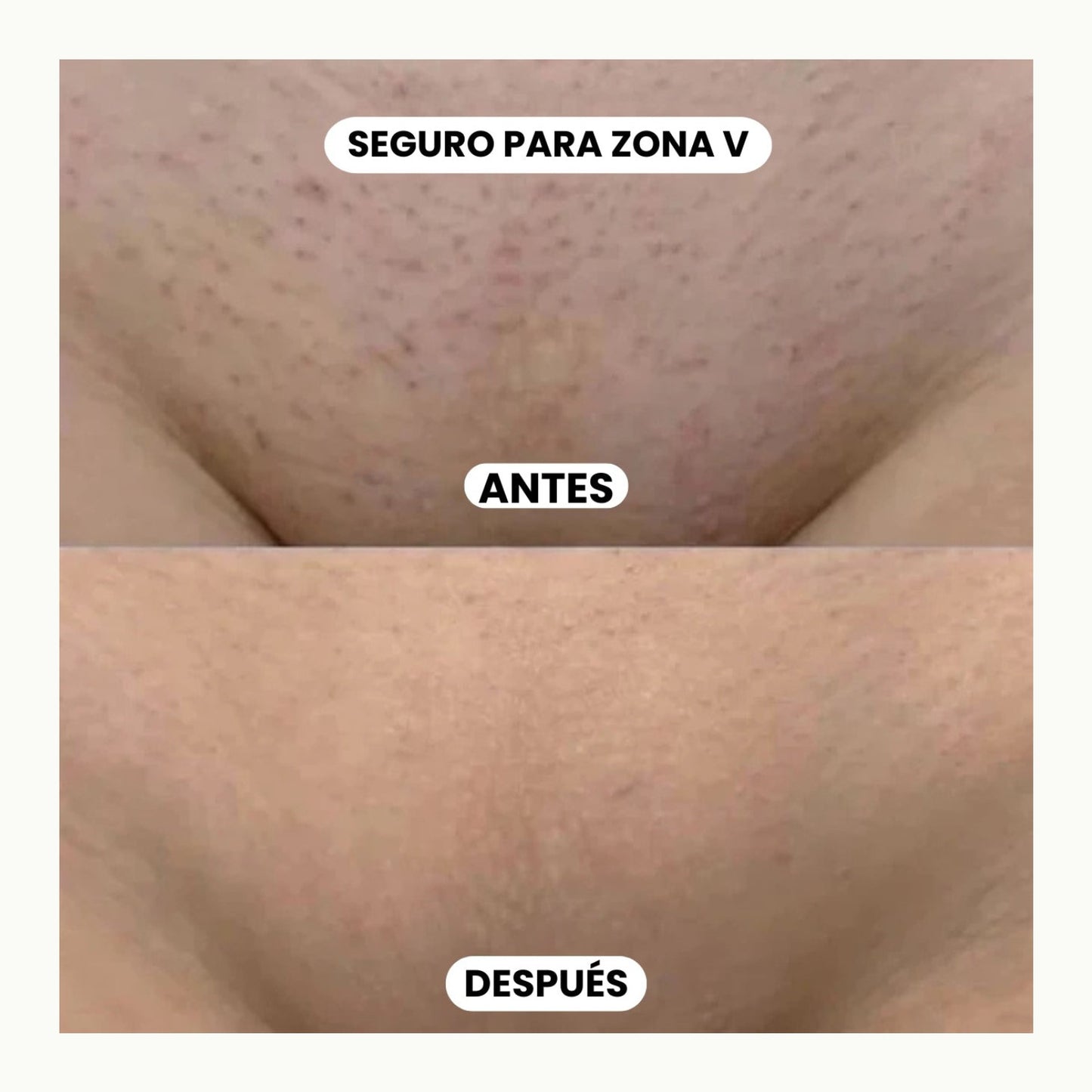 ACEITE CAPILAR CARAMELIA BEAUTY –CYPERUS