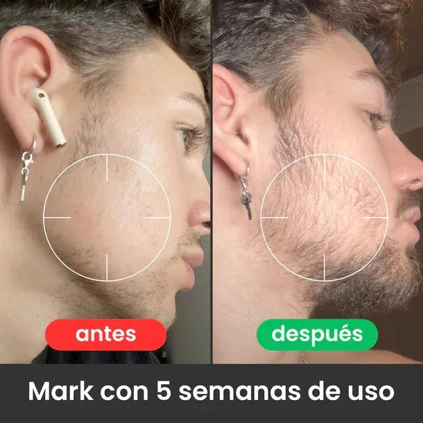 ESTIMULANTE DE BARBA APOLO