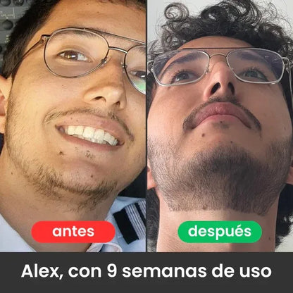 ESTIMULANTE DE BARBA APOLO